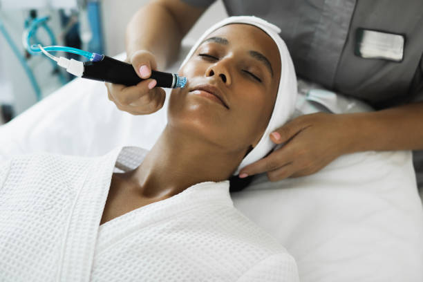 Microneedling facial treatment